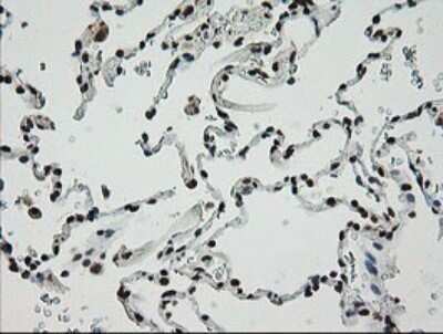 Immunohistochemistry: ZNF447 Antibody (OTI2H7) - Azide and BSA Free [NBP2-74951]