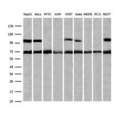 Western Blot: ZNF447 Antibody (OTI2H7)Azide and BSA Free [NBP2-74951]
