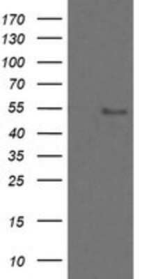 Western Blot: ZNF447 Antibody (OTI2H7)Azide and BSA Free [NBP2-74951]