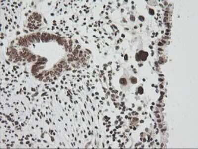 Immunohistochemistry: ZNF447 Antibody (OTI2H7) [NBP2-45442]
