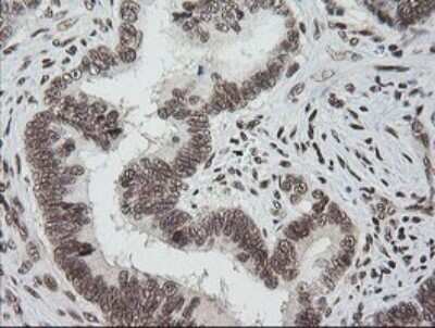 Immunohistochemistry: ZNF447 Antibody (OTI2H7) [NBP2-45442]