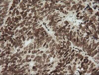 Immunohistochemistry: ZNF447 Antibody (OTI2H7) [NBP2-45442]
