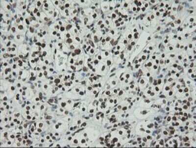Immunohistochemistry: ZNF447 Antibody (OTI2H7) [NBP2-45442]