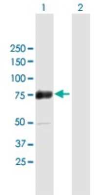 Western Blot: ZNF447 Antibody [H00065982-B01P]