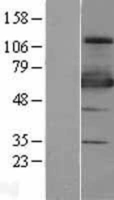 Western Blot: ZNF447 Overexpression Lysate [NBL1-18269]