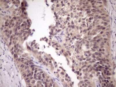 Immunohistochemistry: ZNF449 Antibody (OTI4C6) [NBP2-46453]