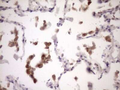 Immunohistochemistry: ZNF449 Antibody (OTI4C6) [NBP2-46453]