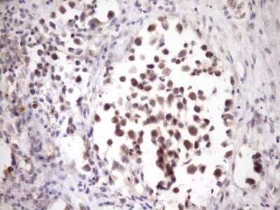 Immunohistochemistry: ZNF449 Antibody (OTI4C6) [NBP2-46453]