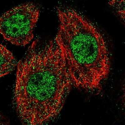 Immunocytochemistry/ Immunofluorescence: ZNF449 Antibody [NBP1-83580]