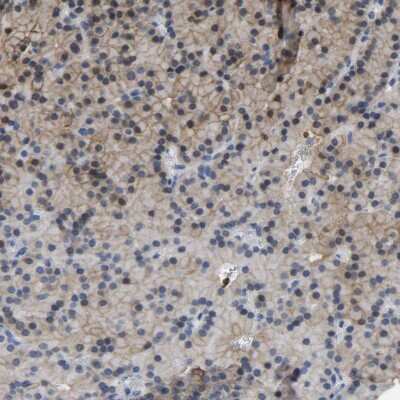 Immunohistochemistry-Paraffin: ZNF449 Antibody [NBP1-83580]
