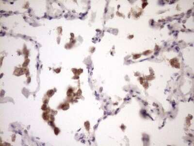 Immunohistochemistry: ZNF449 Antibody (OTI4C6) - Azide and BSA Free [NBP2-74952]