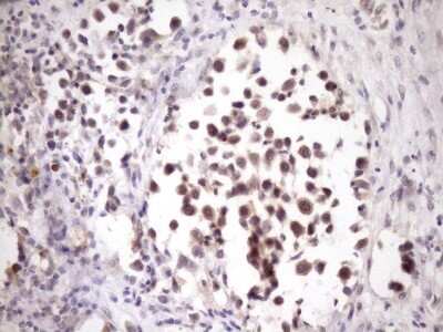 Immunohistochemistry: ZNF449 Antibody (OTI4C6) - Azide and BSA Free [NBP2-74952]