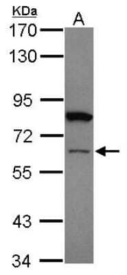 Western Blot: ZNF449 Antibody [NBP1-32591]