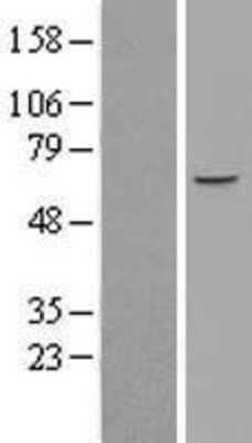 Western Blot: ZNF449 Overexpression Lysate [NBL1-18158]