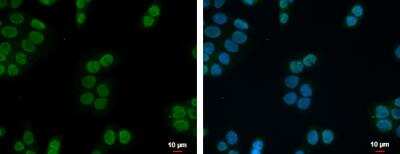 Immunocytochemistry/ Immunofluorescence: ZNF45 Antibody [NBP1-32382]