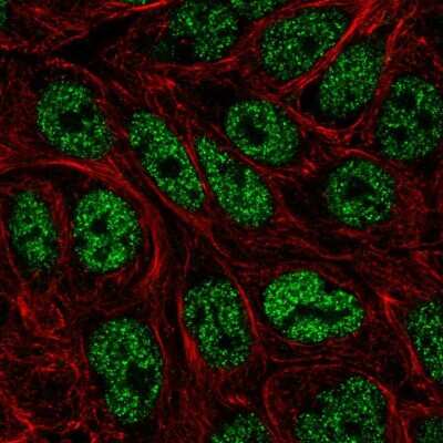 Immunocytochemistry/ Immunofluorescence: ZNF45 Antibody [NBP2-57932]