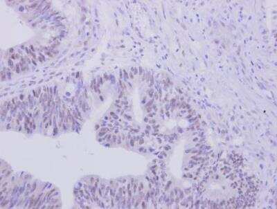 Immunohistochemistry-Paraffin: ZNF45 Antibody [NBP1-32382]