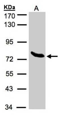 Western Blot: ZNF45 Antibody [NBP1-32382]