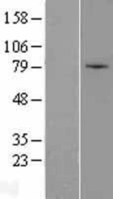 Western Blot: ZNF45 Overexpression Lysate [NBL1-18159]