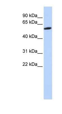 Western Blot: ZNF454 Antibody [NBP1-80197]