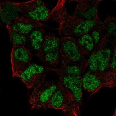 Immunocytochemistry/ Immunofluorescence: ZNF460 Antibody [NBP2-56515]