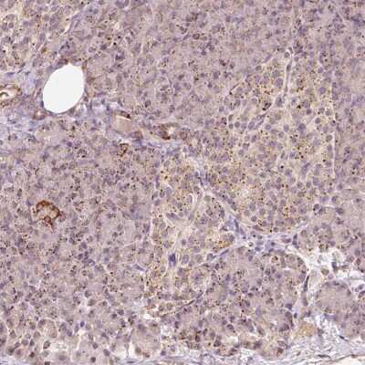 Immunohistochemistry: ZNF460 Antibody [NBP2-49069]