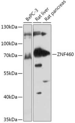 Western Blot: ZNF460 AntibodyAzide and BSA Free [NBP2-94251]