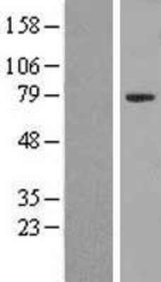 Western Blot: ZNF460 Overexpression Lysate [NBP2-07602]