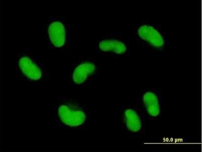 Immunocytochemistry/ Immunofluorescence: ZNF468 Antibody [H00090333-B01P]