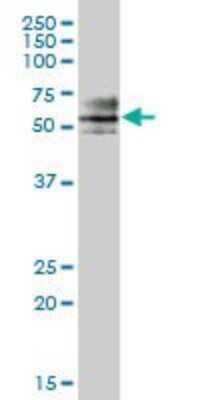 Western Blot: ZNF468 Antibody [H00090333-B01P]