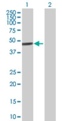 Western Blot: ZNF468 Antibody [H00090333-B01P]
