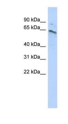 Western Blot: ZNF468 Antibody [NBP1-79437]