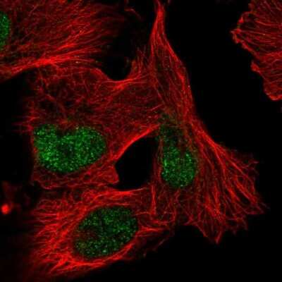 Immunocytochemistry/ Immunofluorescence: ZNF471 Antibody [NBP2-38092]