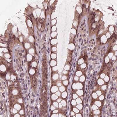 Immunohistochemistry-Paraffin: ZNF471 Antibody [NBP2-38092]