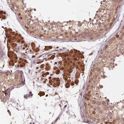 Immunohistochemistry-Paraffin: ZNF471 Antibody [NBP2-38092]