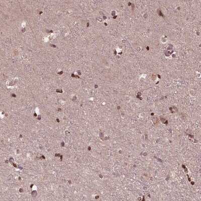 Immunohistochemistry-Paraffin: ZNF471 Antibody [NBP2-38092]
