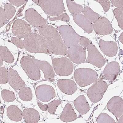 Immunohistochemistry-Paraffin: ZNF471 Antibody [NBP2-38092]