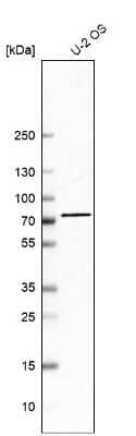 Western Blot: ZNF471 Antibody [NBP2-38092]