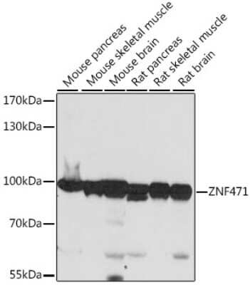 Western Blot: ZNF471 AntibodyAzide and BSA Free [NBP2-94670]