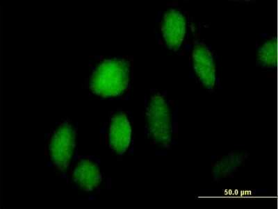 Immunocytochemistry/ Immunofluorescence: ZNF473 Antibody [H00025888-B01P]