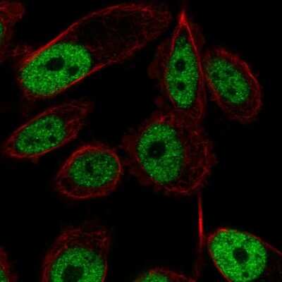 Immunocytochemistry/ Immunofluorescence: ZNF473 Antibody [NBP2-57896]