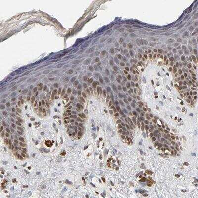 Immunohistochemistry-Paraffin: ZNF473 Antibody [NBP2-13575]