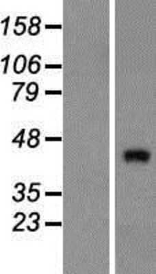 Western Blot: ZNF474 Overexpression Lysate [NBP2-04510]