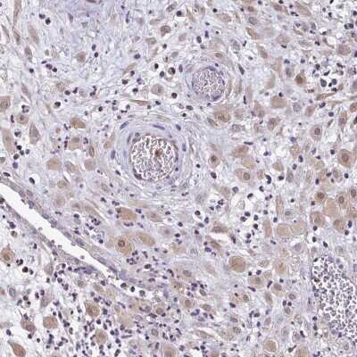 Immunohistochemistry: ZNF475 Antibody [NBP2-38009]