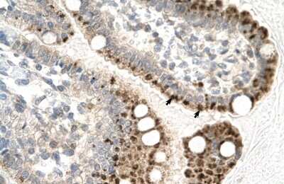 Immunohistochemistry-Paraffin: ZNF475 Antibody [NBP2-86498]