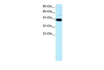 Western Blot: ZNF475 Antibody [NBP2-86497]