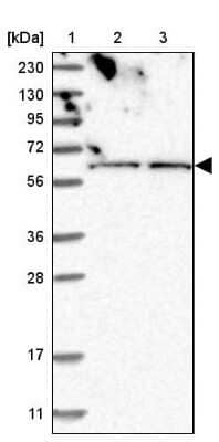 Western Blot: ZNF48 Antibody [NBP1-84088]