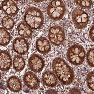 Immunohistochemistry-Paraffin: ZNF480 Antibody [NBP1-81124]