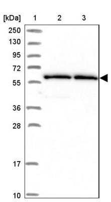 Western Blot: ZNF480 Antibody [NBP1-81124]