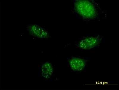 Immunocytochemistry/ Immunofluorescence: ZNF483 Antibody [H00158399-B01P]